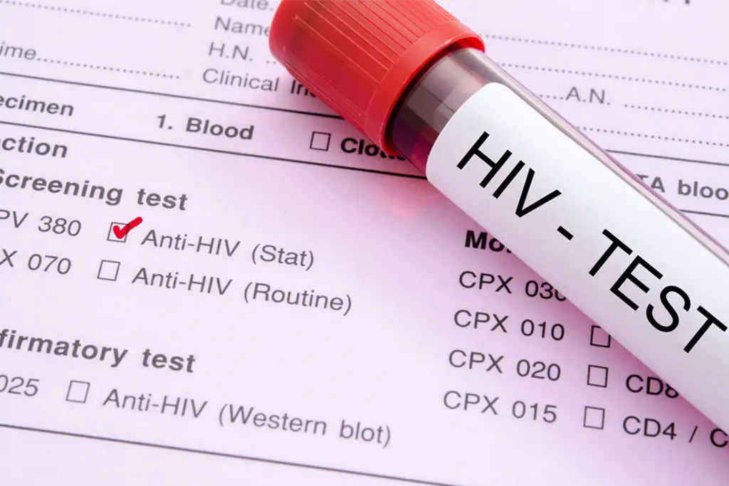 HIV testing 02