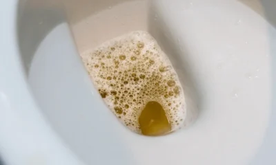 urine