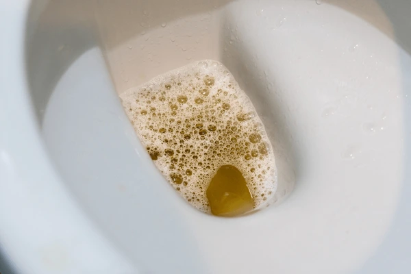 urine