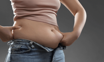 belly fat